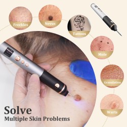 Mole Remover Pen,Skin Tag Remover Dark Spot Remover Freckle Tattoo Wart Mole Removal Tool,15 Levels Adjustable/LCD Screen