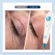 Professional Fibroblast Plasma Pen - Eyelid and Skin Lifting, Face Lift, Acne, Mole, Spot Removal, Tattoo, Anti-Wrinkle Beauty Machine