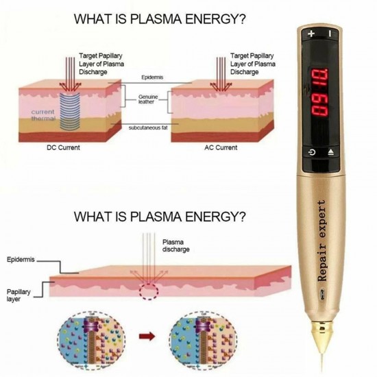 Professional Plasma Pen - High Quality Ozone Plasma Lift Machine for Spots, Scars, Mole Removal, and Skin Tightening