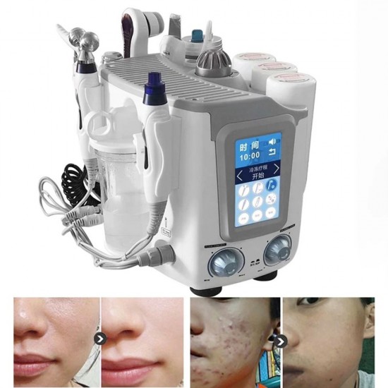 6-in-1 Small Bubble Hydrogen Oxygen Beauty Machine - Professional Facial SPA for Skin Cleaning, Moisturizing